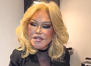 wildenstein blonde