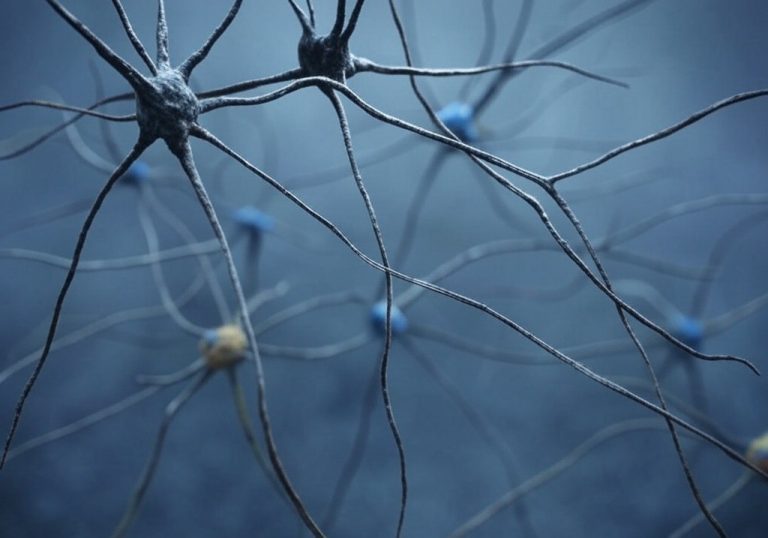 neurwnes